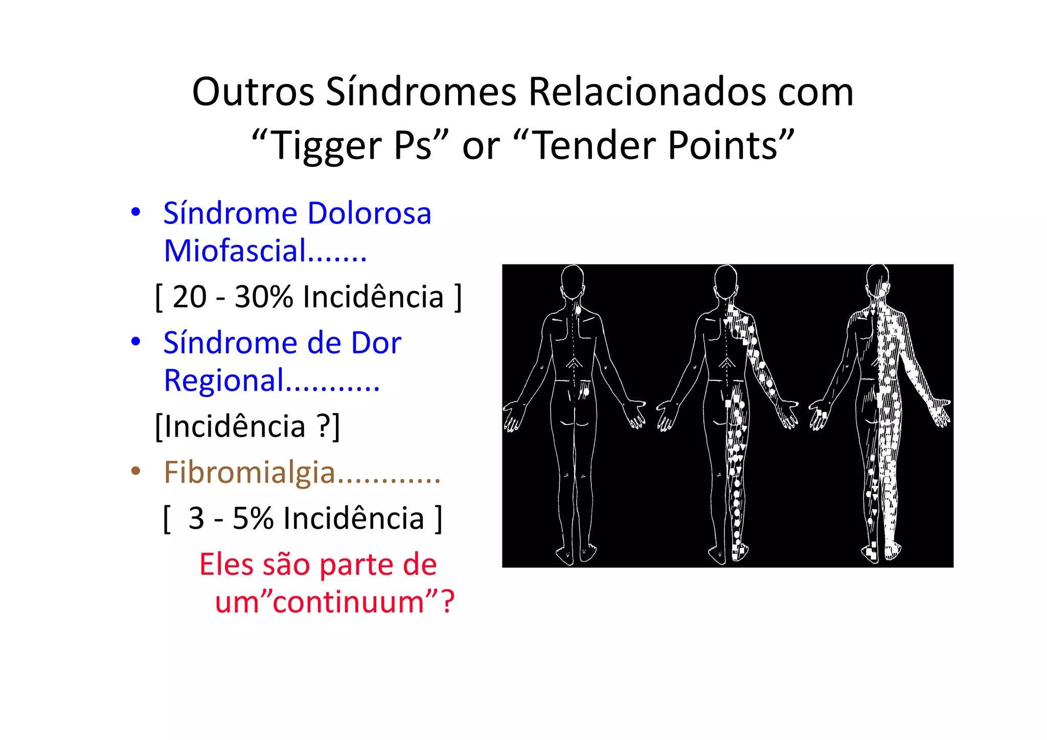 Outros Síndromes Relacionados com
“Tigger Ps” or “Tender Points”
• Síndrome Dolorosa
Miofascial.......
[ 20 - 30% Incidência ]
• Síndrome de Dor
Regional...........
[Incidência ?]
• Fibromialgia............
[ 3 - 5% Incidência ]
Eles são parte de
um”continuum”?
 
