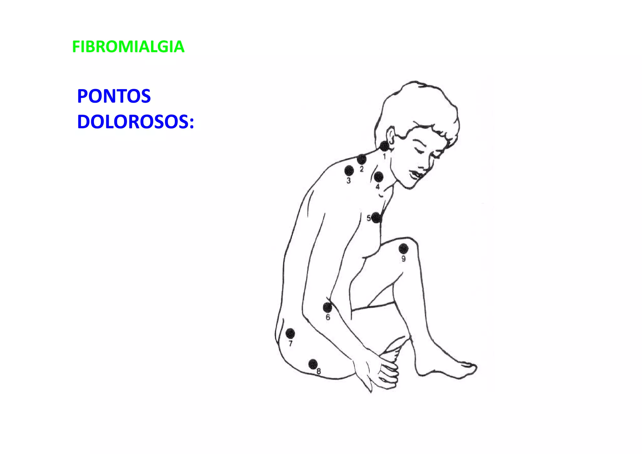 FIBROMIALGIA
PONTOS
DOLOROSOS:
 