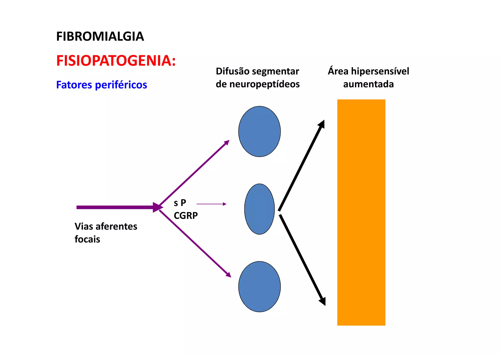 FIBROMIALGIA
FISIOPATOGENIA:
Fatores periféricos
Vias aferentes
focais
s P
CGRP
Difusão segmentar
de neuropeptídeos
Área hipersensível
aumentada
 