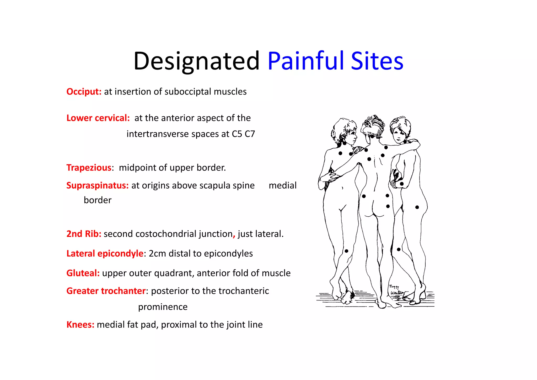 Designated Painful Sites
Occiput: at insertion of subocciptal muscles
Lower cervical: at the anterior aspect of the
intertransverse spaces at C5 C7
Trapezious: midpoint of upper border.
Supraspinatus: at origins above scapula spine medial
border
2nd Rib: second costochondrial junction, just lateral.
Lateral epicondyle: 2cm distal to epicondyles
Gluteal: upper outer quadrant, anterior fold of muscle
Greater trochanter: posterior to the trochanteric
prominence
Knees: medial fat pad, proximal to the joint line
 