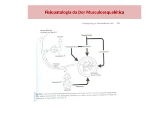Fisiopatologia da Dor Musculoesquelética
 