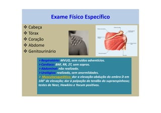 Exame Físico Específico
Cabeça
Tórax
Coração
Abdome
Genitourinário
Respiratório: MVUD, sem ruídos adventícios.
Cardíaco: BNF, RR, 2T, sem sopros.
Abdominal: não realizado.
Urológico: realizado, sem anormlidades.
Musculoesquelético: dor a elevação-abdução do ombro D em
100° de elevação; dor à palpação do tendão do supraespinhoso;
testes de Neer, Hawkins e Yocum positivos.
 