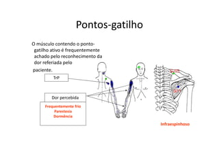 Pontos-gatilho
O músculo contendo o ponto-
gatilho ativo é frequentemente
achado pelo reconhecimento da
dor referiada pelo
paciente.
TrP
Dor percebida
Frequentemente frio
Parestesia
Dormência
Infraespinhoso
 