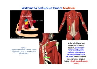 Síndrome do Desfiladeiro Torácico Miofascial
A dor referida de pon
tos-gatilho presentes
nos mm. escaleno an-
terior e médio, infra-
espinhal, subescapular
serrátil posterior e gran
de dorsal é a causa de dor
no ombro e ao longo do
braço – simula o padrão de dor
da SDT
Fonte:
Lucy White Fergunson e Robert Gerwin
Tratamento Clínico da Dor Miofascial
Artmed 2007
 