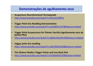 Demonstrações de agulhamento seco
• Acupuntura Neurofuncional Termoguiada
• http://www.youtube.com/watch?v=EEJoJUUdKPw
• Trigger Point Dry Needling Demonstration
• http://www.youtube.com/watch?v=oVpr8DYm1EY&feature=related
• Trigger Point Acupuncture for Plantar Fasciitis (agulhamento seco da
panturrilha)
• http://www.youtube.com/watch?v=0pNerGQoNmM&feature=related
• trigger point dry needling
• http://www.youtube.com/watch?v=QGVNtbVxlHQ&feature=related
• The Gluteus Medius Trigger Points and Low Back Pain
• http://www.youtube.com/watch?v=0UJDe4DkLDE&feature=related
 
