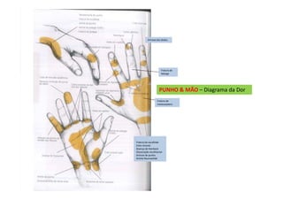 PUNHO & MÃO – Diagrama da Dor
Artrose dos dedos
Fratura de
falange
Fratura de
metacarpiano
Fratura de escafóide
Cisto sinovial
Doença de Kienbock
Dissociação escafolunar
Artrose de punho
Artrite Reumatóide
 