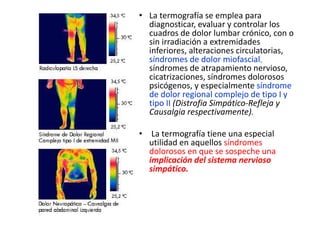 • La termografía se emplea para
diagnosticar, evaluar y controlar los
cuadros de dolor lumbar crónico, con o
sin irradiación a extremidades
inferiores, alteraciones circulatorias,
síndromes de dolor miofascial,
síndromes de atrapamiento nervioso,
cicatrizaciones, síndromes dolorosos
psicógenos, y especialmente síndrome
de dolor regional complejo de tipo I y
tipo II (Distrofia Simpático-Refleja y
Causalgia respectivamente).
• La termografía tiene una especial
utilidad en aquellos síndromes
dolorosos en que se sospeche una
implicación del sistema nervioso
simpático.
 
