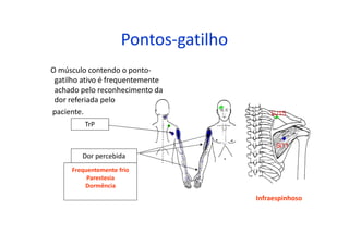 Pontos-gatilho
O músculo contendo o ponto-
gatilho ativo é frequentemente
achado pelo reconhecimento da
dor referiada pelo
paciente.
TrP
Dor percebida
Frequentemente frio
Parestesia
Dormência
Infraespinhoso
 