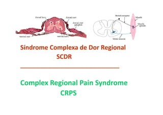 Síndrome Complexa de Dor Regional
SCDR
________________________________
Complex Regional Pain Syndrome
CRPS
 