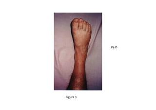 Figura 3
Pé D
 