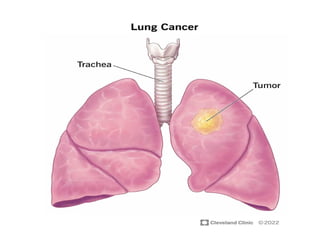 vnd.openxmlformats-officedocument.presss