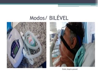 Modos/ BILÉVEL
Fonte: Arquivo pessoal
 