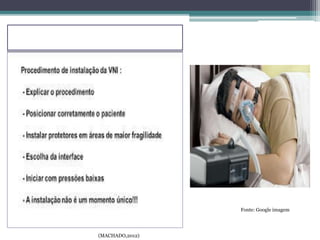 (MACHADO,2012)
Fonte: Google imagem
 