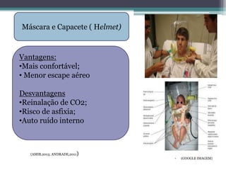 • (GOOGLE IMAGEM)
Máscara e Capacete ( Helmet)
Vantagens:
•Mais confortável;
• Menor escape aéreo
Desvantagens
•Reinalação de CO2;
•Risco de asfixia;
•Auto ruído interno
(AMIB,2013; ANDRADE,2011)
 