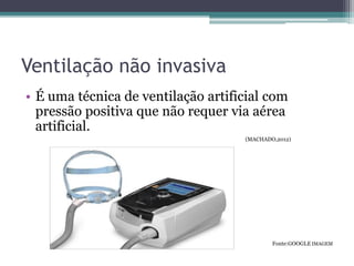 Ventilação não invasiva
• É uma técnica de ventilação artificial com
pressão positiva que não requer via aérea
artificial.
(MACHADO,2012)
Fonte:GOOGLE IMAGEM
 