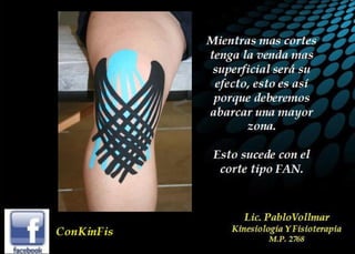 Principios Básicos del kinesiotaping