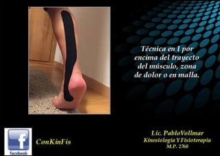 Principios Básicos del kinesiotaping