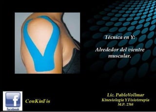 Principios Básicos del kinesiotaping
