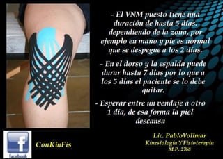 Principios Básicos del kinesiotaping