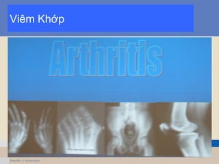 Viêm Khớp
 