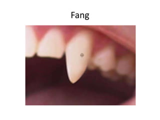 Fang
 