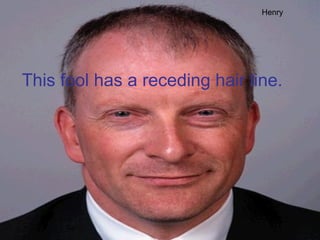 This fool has a receding hair line. Henry 