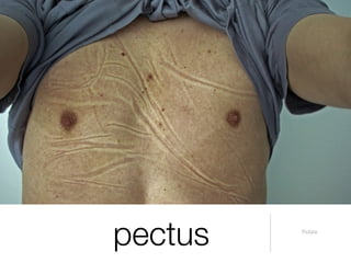 pectus   Pictūra
 