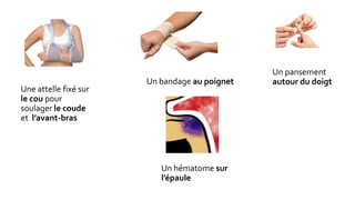 Une attelle fixé sur
le cou pour
soulager le coude
et l’avant-bras
Un bandage au poignet
Un pansement
autour du doigt
Un hématome sur
l’épaule
 