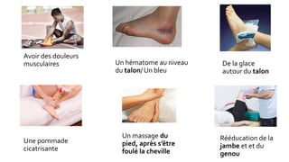 Un hématome au niveau
du talon/ Un bleu
De la glace
autour du talon
Une pommade
cicatrisante
Un massage du
pied, après s’être
foulé la cheville
Rééducation de la
jambe et et du
genou
Avoir des douleurs
musculaires
 