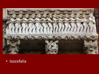 • Isocefalia
 