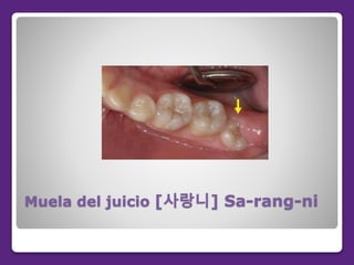 Muela del juicio [사랑니] Sa-rang-ni
 