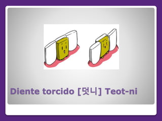 Diente torcido [덧니] Teot-ni
 