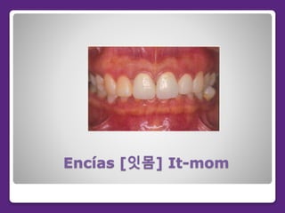 Encías [잇몸] It-mom
 
