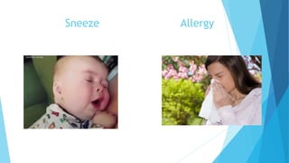 Sneeze Allergy
 