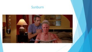 Sunburn
 