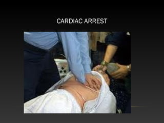 CARDIAC ARREST
 