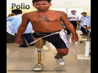 http://www.flickr.com/photos/cambodiatrust/2781201572
 