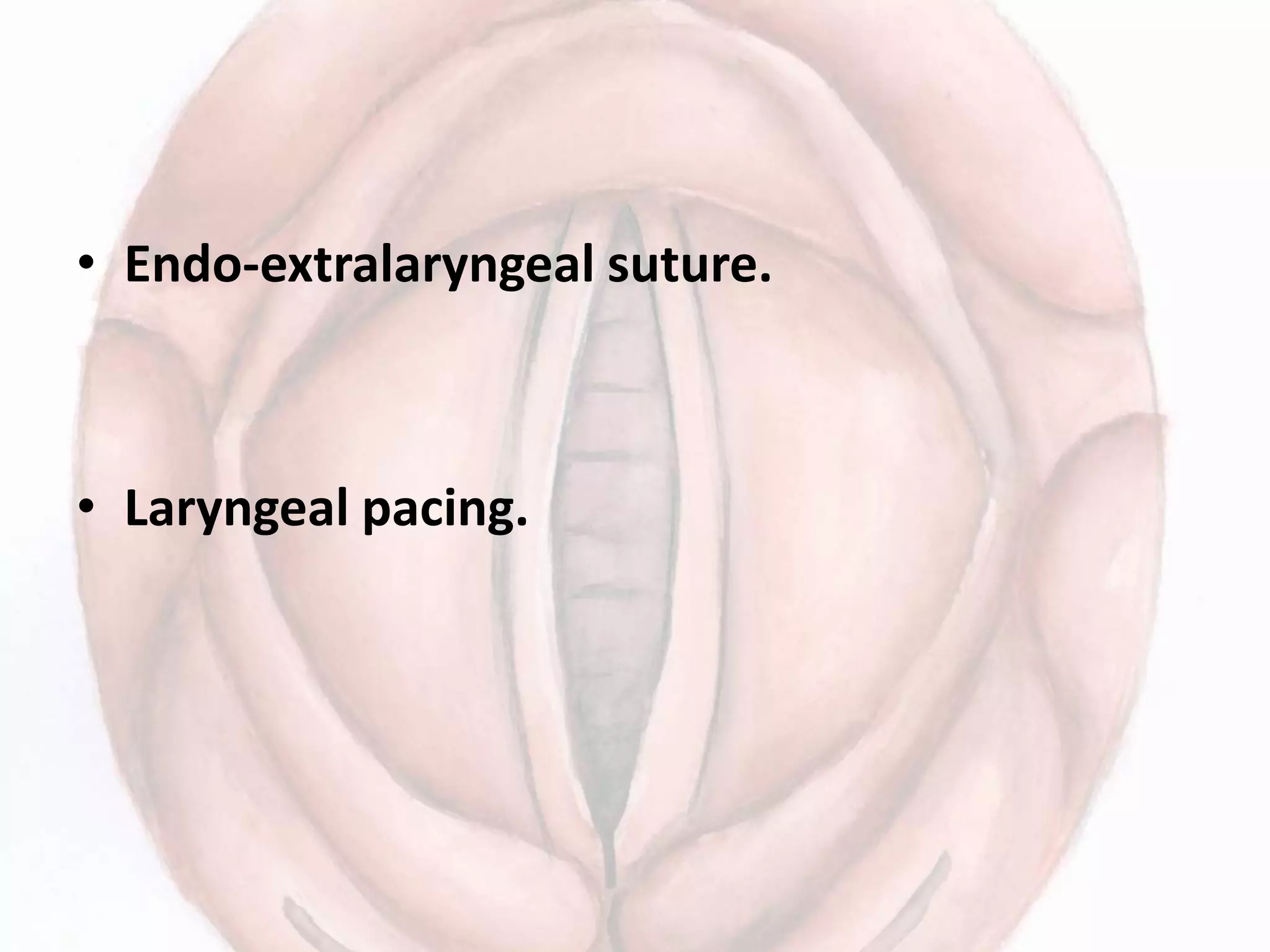 • Endo-extralaryngeal suture.
• Laryngeal pacing.
 