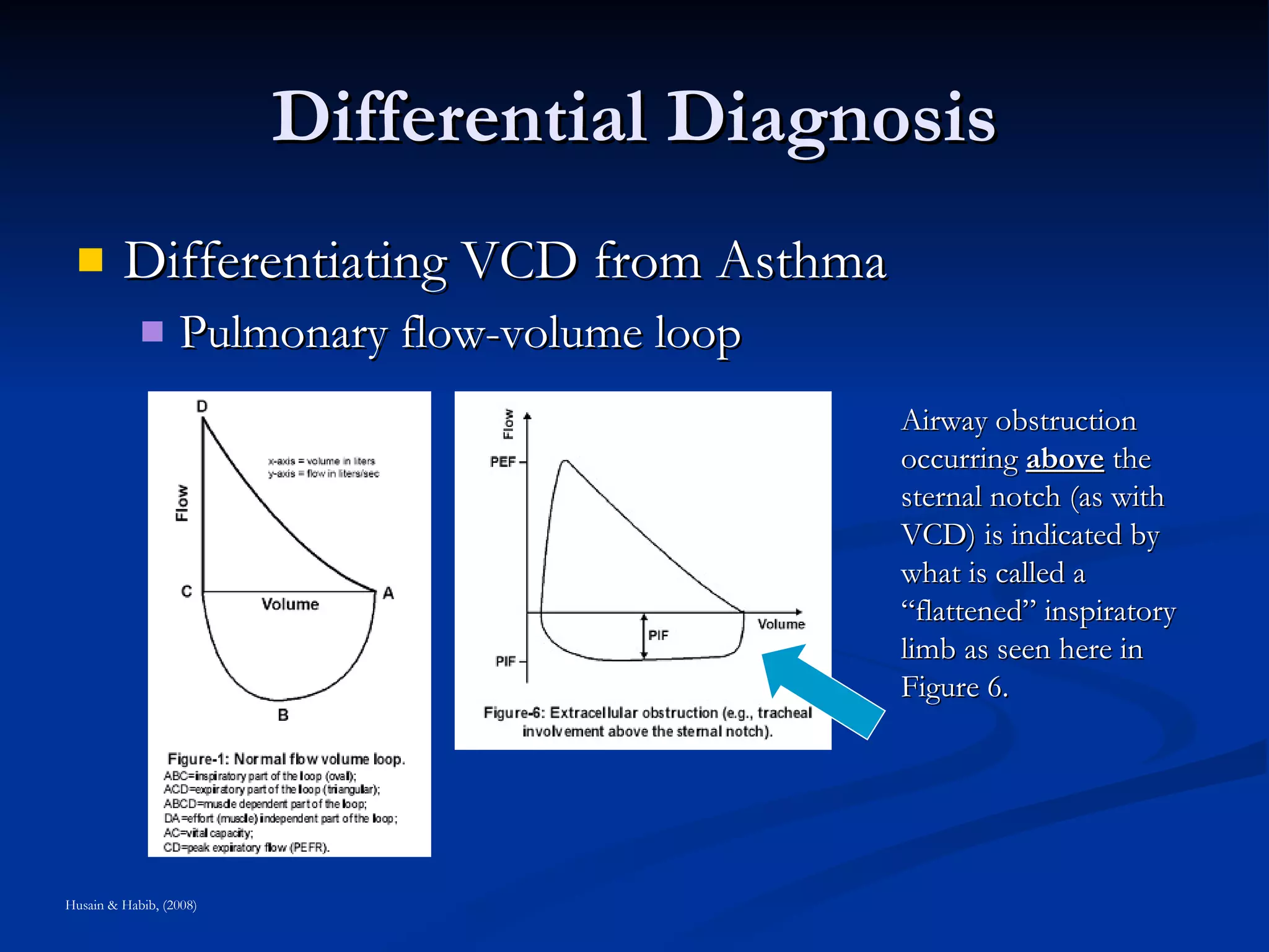 Differential Diagnosis Differentiating VCD from Asthma Pulmonary flow-volume loop Husain & Habib, (2008) Airway obstruction occurring  above  the sternal notch (as with VCD) is indicated by what is called a “flattened” inspiratory limb as seen here in Figure 6. 