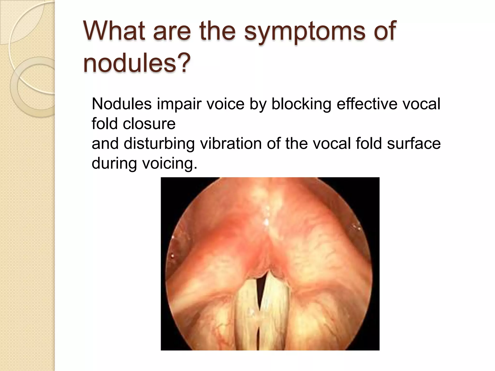 What are the symptoms of
nodules?
Nodules impair voice by blocking effective vocal
fold closure
and disturbing vibration of the vocal fold surface
during voicing.
 