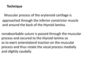 Technique
Muscular process of the arytenoid cartilage is
approached through the inferior constrictor muscle
and around the back of the thyroid lamina.
nonabsorbable suture is passed through the muscular
process and secured to the thyroid lamina so
as to exert anterolateral traction on the muscular
process and thus rotate the vocal process medially
and slightly caudally
 