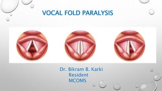 VOCAL FOLD PARALYSIS
Dr. Bikram B. Karki
Resident
MCOMS
 