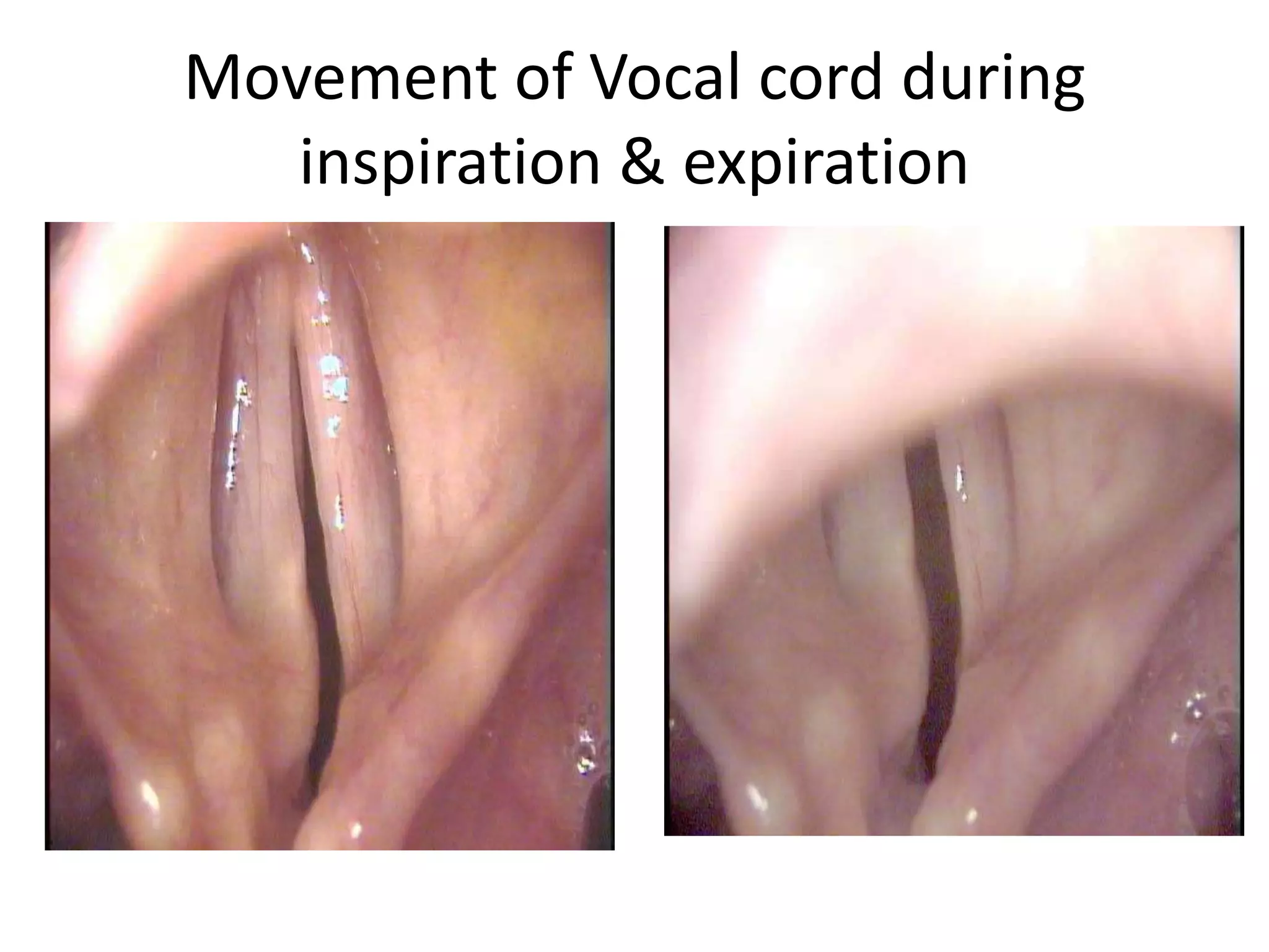 Movement of Vocal cord during
inspiration & expiration
 