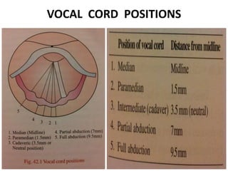 VOCAL CORD POSITIONS
 