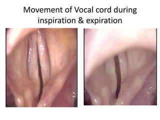 Movement of Vocal cord during
inspiration & expiration
 