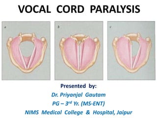 VOCAL CORD PARALYSIS
Presented by:
Dr. Priyanjal Gautam
PG – 3rd Yr. (MS-ENT)
NIMS Medical College & Hospital, Jaipur
 