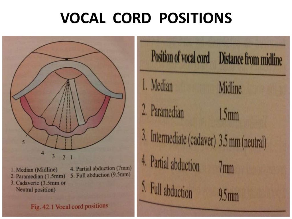 Vocal cord paralysis