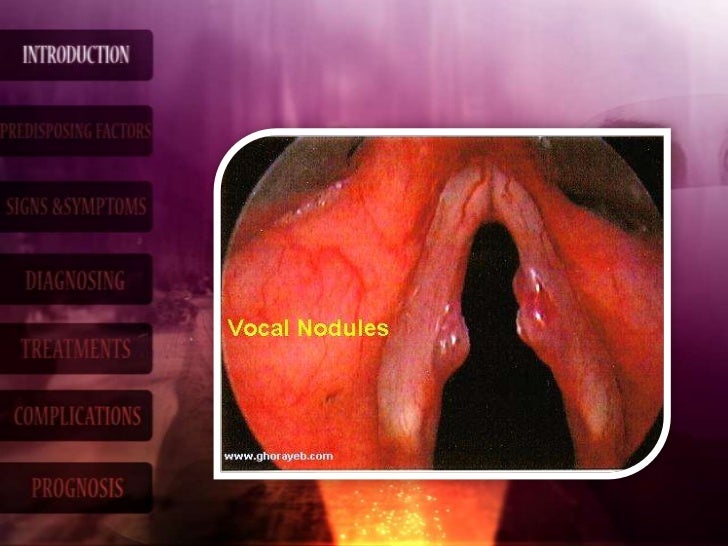 Vocal nodules