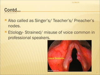VOCAL NODULES IMP n SLO by DR salman sir | PPT