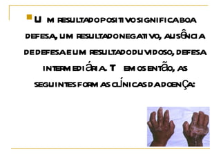 Um resultado positivo significa boa defesa, um resultado negativo, ausência de defesa e um resultado duvidoso, defesa intermediária. Temos então, as seguintes formas clínicas da doença: 